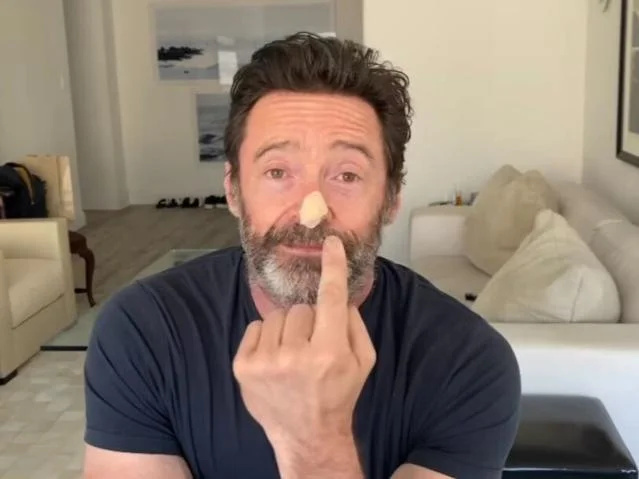 Kui tõsine on Hugh Jackmani nahavähk: kõik, mida pead teadma Wolverine Stari terviseprobleemi kohta