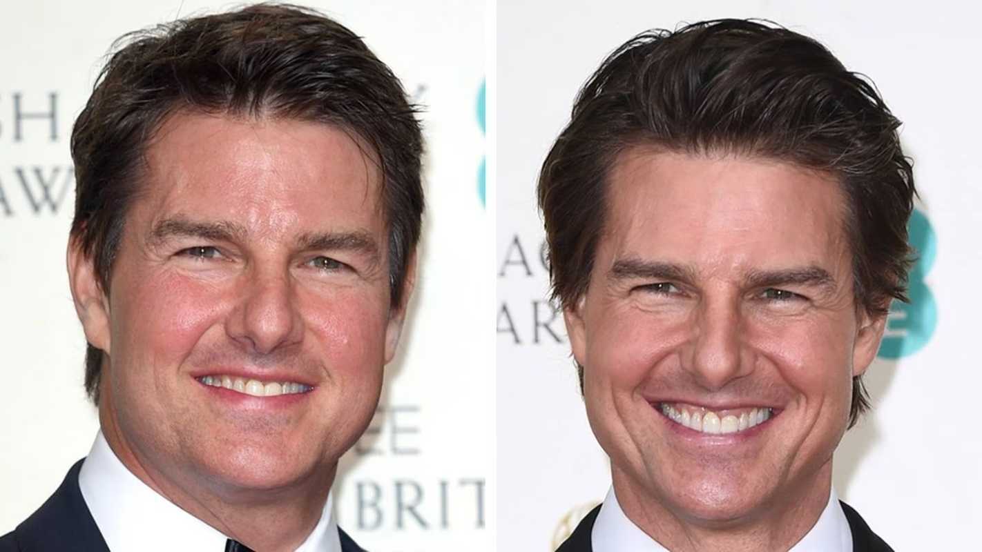Dünyanın tüm botoks stoklarını çalmaya yönelik İmkansız görev türü: Tom Cruise, Şişkin Yüzüyle Büyük Plastik Cerrahi Söylentilerini Ateşledi