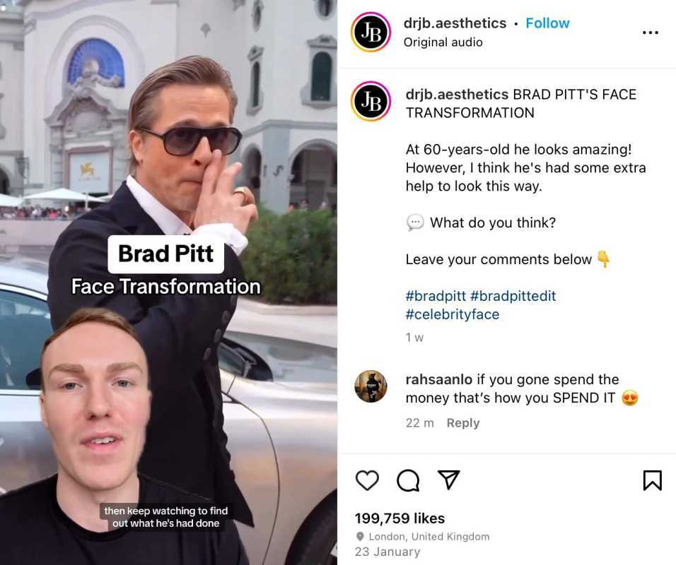 Doktor odhaľuje proces plastickej chirurgie Brada Pitta s dôkazom
